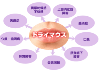 ドライマウス