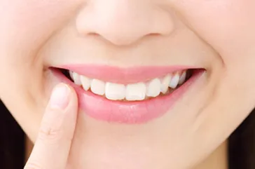 矯正歯科とは、健康できれいな歯並び、新しい自分への第一歩!